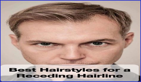 What hairstyle is best for receding hairline?
